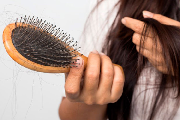 Caída cabello